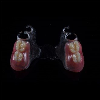 Uklonjiva akrilna djelomična proteza