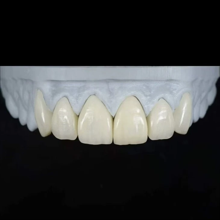E.max Press monolitni furniri