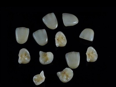 Kako odabrati najbolji zubni ljepilo za krunice: Najnoviji vodič