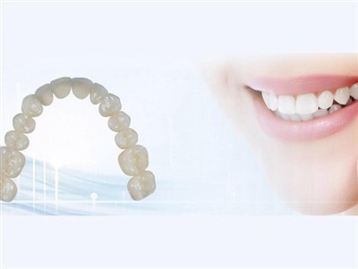 Outsourcing dentalne laboratorije: prednosti, nedostaci i ključna razmatranja