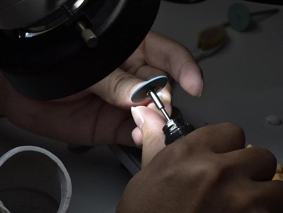 Koliko dugo traju PFM krune? Prosječan životni vijek, faktori i savjeti za njegu