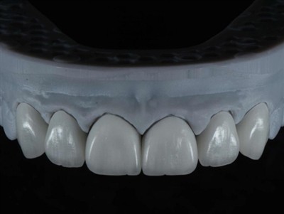 Kako angažovati dentalnog laboratorijskog tehničara za rad u inostranstvu: sv...