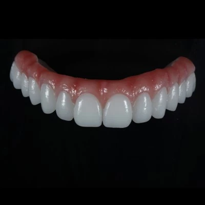 Metal-Besplatno sve-na-X Zirconia mostu